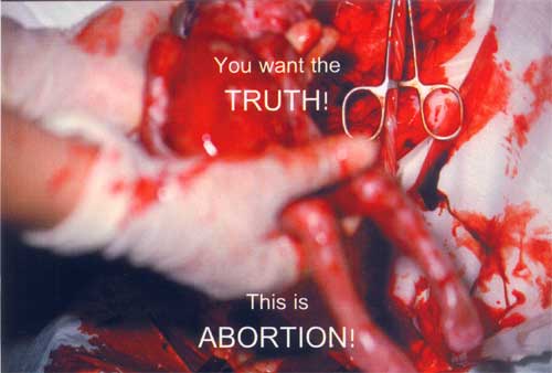Abortion quote, the truth about abortion